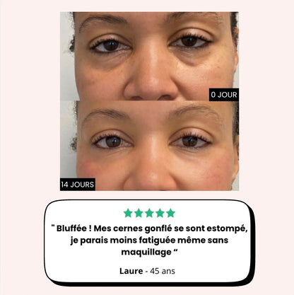 Soin du regard "LumiLift": Rituel anti-cernes pigmentées