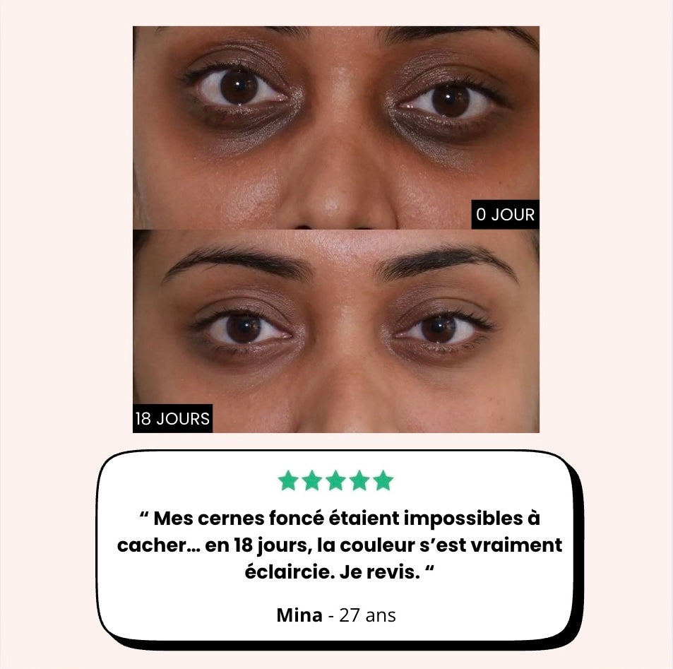 Soin du regard "LumiLift": Rituel anti-cernes pigmentées