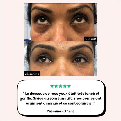 Soin du regard "LumiLift": Rituel anti-cernes pigmentées