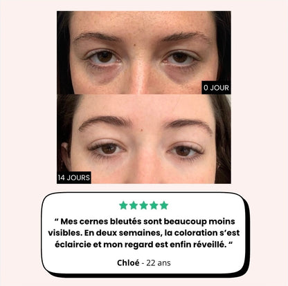 Soin du regard "LumiLift": Rituel anti-cernes pigmentées